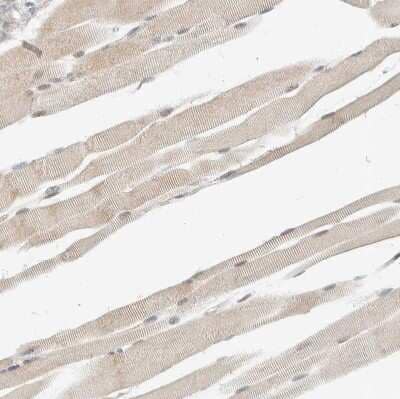 Immunohistochemistry-Paraffin: Adenylosuccinate Synthase Antibody [NBP1-90360] - Staining of human skeletal muscle shows weak cytoplasmic positivity in myocytes.