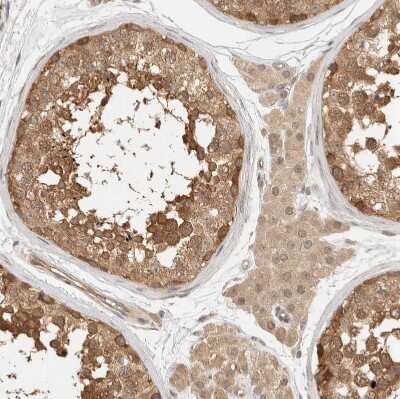 Immunohistochemistry-Paraffin: Adenylosuccinate Synthase Antibody [NBP1-90360] - Staining of human testis shows moderate cytoplasmic positivity in cells in seminiferous ducts.