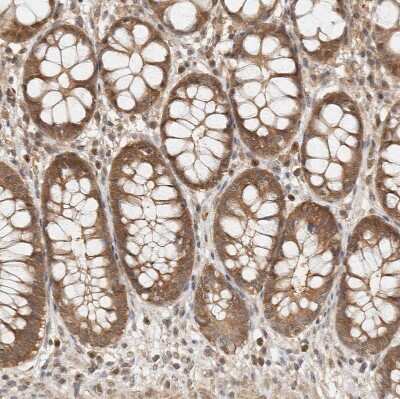 Immunohistochemistry-Paraffin: Adenylosuccinate Synthase Antibody [NBP1-90360] - Staining of human rectum shows moderate to strong cytoplasmic positivity in glandular cells.