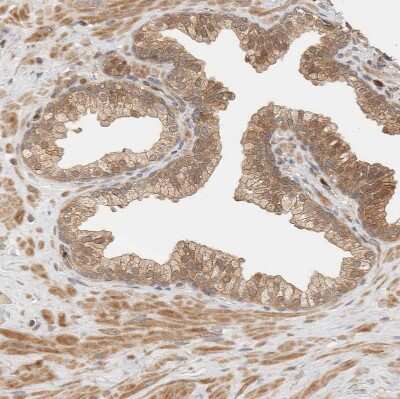 Immunohistochemistry-Paraffin: Adenylosuccinate Synthase Antibody [NBP1-90360] - Staining of human prostate shows moderate cytoplasmic and membranous positivity in glandular cells.