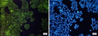 Immunocytochemistry/Immunofluorescence: Adenylosuccinate Synthase Antibody (S05-8F8) [NBP3-14991] - Immunofluorescence of Adenylosuccinate Synthase (green) in Hela cells using Adenylosuccinate Synthase Rabbit mAb at dilution 1/200, and DAPI (blue)