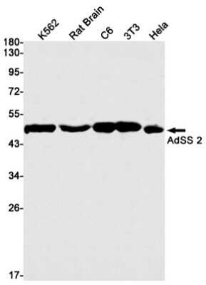 Western Blot: Adenylosuccinate Synthase Antibody (S05-8F8) [NBP3-14991] - Western blot detection of Adenylosuccinate Synthase in K562, Rat Brain, C6, 3T3, Hela cell lysates using Adenylosuccinate Synthase Rabbit mAb (1:1000 diluted). Predicted band size: 50kDa. Observed band size: 50kDa.