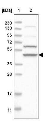 Western Blot: Adenylosuccinate Synthase Antibody [NBP1-90360] - Lane 1: Marker  [kDa] 230, 130, 95, 72, 56, 36, 28, 17, 11.  Lane 2: Human cell line RT-19