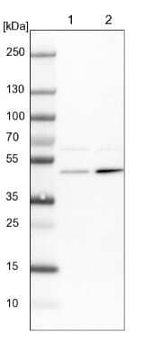 Western Blot: Adenylosuccinate Synthase Antibody [NBP1-90360] - Lane 1: NIH-3T3 cell lysate (Mouse embryonic fibroblast cells). Lane 2: NBT-II cell lysate (Rat Wistar bladder tumor cells).