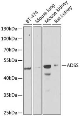 Western Blot: Adenylosuccinate Synthase Antibody [NBP2-92661] - Analysis of extracts of various cell lines, using Adenylosuccinate Synthase at 1:1000 dilution.Secondary antibody: HRP Goat Anti-Rabbit IgG (H+L) at 1:10000 dilution.Lysates/proteins: 25ug per lane.Blocking buffer: 3% nonfat dry milk in TBST.Detection: ECL Basic Kit .Exposure time: 90s.