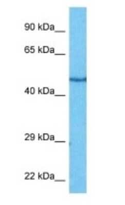 Western Blot: Adenylosuccinate Synthase Antibody [NBP3-10839] - Western blot analysis of Adenylosuccinate Synthase in NIH3T3 Whole Cell lysates. Antibody dilution at 1ug/ml