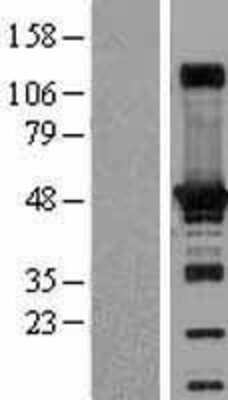 Western Blot: Adenylosuccinate Synthase Overexpression Lysate (Adult Normal) [NBL1-07364] Left-Empty vector transfected control cell lysate (HEK293 cell lysate); Right -Over-expression Lysate for Adenylosuccinate Synthase.