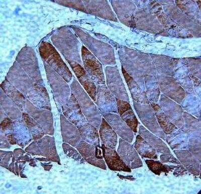 Immunohistochemistry-Paraffin AdipoR2 Antibody