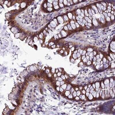 Immunohistochemistry-Paraffin: AdipoR2 Antibody [NBP1-91652] - Staining of human colon shows moderate cytoplasmic positivity in glandular cells.