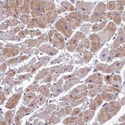 Immunohistochemistry-Paraffin: AdipoR2 Antibody [NBP1-91652] - Staining of human Heart muscle shows moderate cytoplasmic positivity in cardiomyocytes.