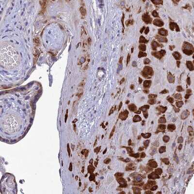 Immunohistochemistry-Paraffin: AdipoR2 Antibody [NBP1-91652] - Staining of human Placenta shows strong cytoplasmic positivity in decidual cells.