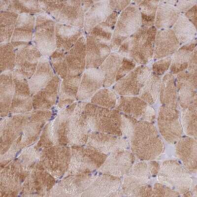 Immunohistochemistry-Paraffin AdipoR2 Antibody