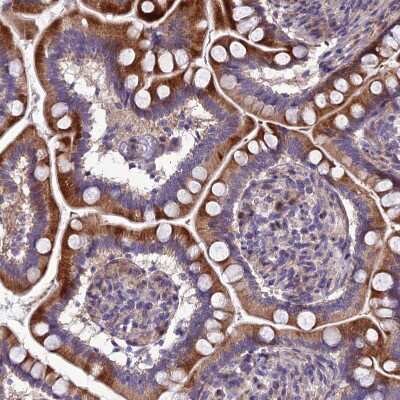 Immunohistochemistry-Paraffin: AdipoR2 Antibody [NBP1-91652] - Staining of human Small intestine shows moderate cytoplasmic positivity in glandular cells.