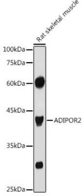 Western Blot AdipoR2 Antibody - Azide and BSA Free