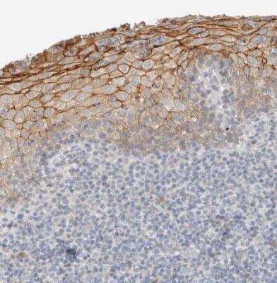 Immunohistochemistry-Paraffin: Adipolin/FAM132A Antibody [NBP1-90700] - Staining of human tonsil shows moderate membranous and cytoplasmic positivity in squamous epithelial cells.