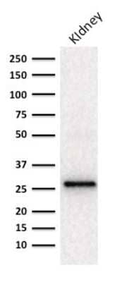 Western Blot: Adiponectin/Acrp30 Antibody (ADPN/1370) [NBP2-47652] - Western blot Analysis of human Kidney lysate using Adiponectin/Acrp30 Antibody (ADPN/1370).