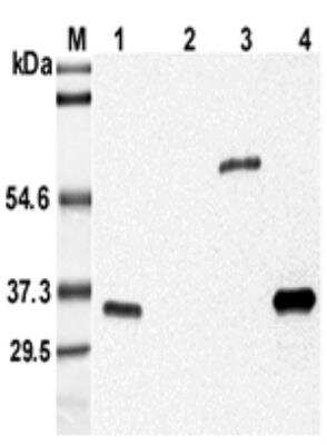 Western Blot: Adiponectin/Acrp30 Antibody (MADI 04) - Azide and BSA Free [NBP2-80031] - Analysis using Adiponectin/Acrp30 (mouse), mAb (MADI 04) (Prod. No. NBP2-80031) at 1:5'000 dilution.