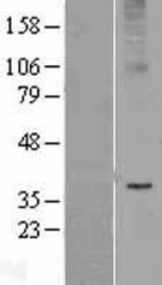 Western Blot AdipoR2 Overexpression Lysate