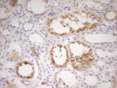 Immunohistochemistry: Adrenomedullin/ADM Antibody (OTI8A1) - Azide and BSA Free [NBP2-70100] -  Analysis of Human Kidney tissue. (Heat-induced epitope retrieval by 1 mM EDTA in 10mM Tris, pH8.5, 120 degrees C for 3min)