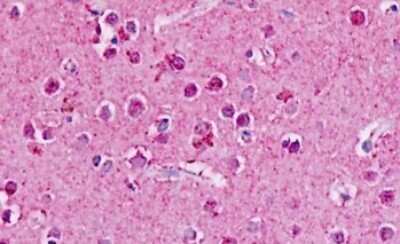 Immunohistochemistry-Paraffin: Adrenomedullin R/ADMR/GPR182 Antibody [NB100-58988] - Human, Brain, neurons: Formalin-Fixed Paraffin-Embedded (FFPE)