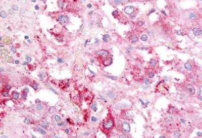 Immunohistochemistry-Paraffin: Adrenomedullin R/ADMR/GPR182 Antibody [NB100-58988] - ADMR/GPR182 Antibody IHC of human adrenal. Immunohistochemistry of formalin-fixed, paraffin-embedded tissue after heat-induced antigen retrieval.