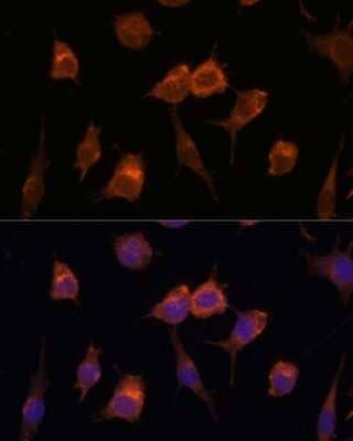 Immunocytochemistry/Immunofluorescence: Advillin Antibody [NBP2-92263] - Analysis of L929 cells using Advillin at dilution of 1:100. Blue: DAPI for nuclear staining.