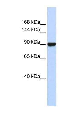 Western Blot: Advillin Antibody [NBP1-80312] - Titration: 0.2-1 ug/ml, Positive Control: Human Liver.