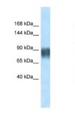 Western Blot: Advillin Antibody [NBP1-91606] - Titration: 1.0 ug/ml Positive Control: Rat Muscle.