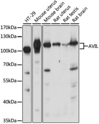 Western Blot: Advillin Antibody [NBP2-92263] - Analysis of extracts of various cell lines, using Advillin at 1:1000 dilution.Secondary antibody: HRP Goat Anti-Rabbit IgG (H+L) at 1:10000 dilution.Lysates/proteins: 25ug per lane.Blocking buffer: 3% nonfat dry milk in TBST.Detection: ECL Basic Kit .Exposure time: 30s.