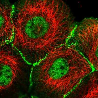 Immunocytochemistry/Immunofluorescence: Afadin/AF-6 Antibody [NBP1-90219] - Immunofluorescent staining of human cell line A-431 shows localization to nucleoplasm, plasma membrane & cell junctions.