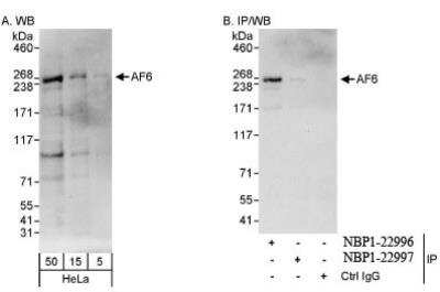 Western Blot: Afadin/AF-6 Antibody [NBP1-22996] - Whole cell lysate from HeLa cells. AF6 was also immunoprecipitated, albeit poorly, by rabbit anti-AF6 antibody NBP1-22997.