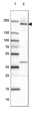 Western Blot: Afadin/AF-6 Antibody [NBP1-90218] - Lane 1: Marker [kDa] 250, 130, 100, 70, 55, 35, 25, 15, 10Lane 2: Human Esophagus tissue