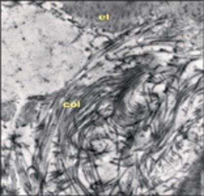 Electron Microscopy: Aggrecan Antibody (CS-56) [NB120-11570] - Normal rabbit aorta, Lowicryl K4M thin section, stained with Monoclonal Anti-Chondroitin Sulfate (NB120-11570) and Goat Anti-Mouse IgM (u-chain specific) 10 nm gold. Counterstain was uranyl acetate and Reynold's lead citrate. Magnification 44,600x. (el=Elastin, col=Collagen). Data supplied by Z. Gallis, McGill University, Montreal.