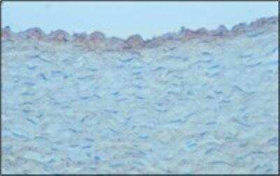 Immunohistochemistry-Frozen: Aggrecan Antibody (CS-56) [NB120-11570] - staining of a frozen section of normal rabbit aorta. Data supplied by Z. Gallis, McGill University, Montreal.