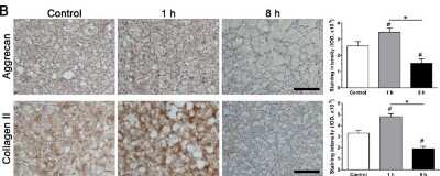 Immunohistochemistry: Aggrecan Antibody (CS-56) [NB120-11570] - Long-term load duration decreased expression of NP matrix macromolecules in porcine disc NP cells. Immunohistochemistry staining of aggrecan and collagen II. Magnification: 200x, scale =100 um. The results showed that long-term load duration (8 h per day) significantly decreased gene expression of matrix molecules (aggrecan and collagen II) and their protein deposition within the NP tissue compared with the short-term load duration (1 h per day) and the control (non-compression). Data are expressed as the means +/- S.D., n=3. #: indicates a significant difference (P<0.05) when compared with the control group. *: indicates a significant difference between two groups (P<0.05). Image collected and cropped by CiteAb from the following publication (//portlandpress.com/bioscirep/article-lookup/doi/10.1042/BSR20160582) licensed under a CC-BY license.