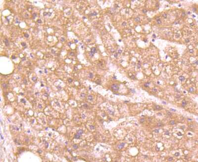 Immunohistochemistry-Paraffin: Aggrecan Antibody (JA40-23) [NBP2-67120] - Analysis of paraffin-embedded human liver tissue using anti-Aggrecan antibody. Counter stained with hematoxylin.