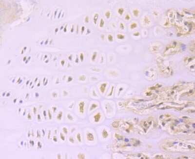 Immunohistochemistry-Paraffin: Aggrecan Antibody (JA40-23) [NBP2-67120] - Analysis of paraffin-embedded rat cartilage tissue using anti-Aggrecan antibody. Counter stained with hematoxylin.