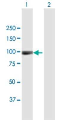 Western Blot: Aggrecan Antibody [H00000176-B01P] - Analysis of ACAN expression in transfected 293T cell line by ACAN polyclonal antibody.  Lane 1: AGC1 transfected lysate(79.31 KDa). Lane 2: Non-transfected lysate.