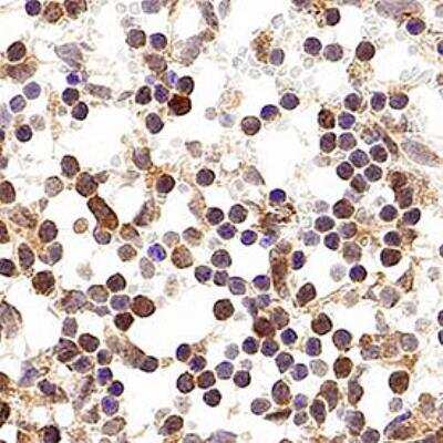 Immunohistochemistry: Aggressive Tumor Markers Antibody Pack [NBP1-78939] - Analysis of FFPE mouse spleen using p16INK4a/CDKN2A antibody (NB200-106)at 10 ug/mL on a Bond Rx autostainer (Leica Biosystems). The assay involved 20 minutes of heat induced antigen retrieval (HIER) using 10mM sodium citrate buffer (pH 6.0) and endogenous peroxidase quenching with peroxide block. The sections were incubated with primary antibody for 30 minutes and Bond Polymer Refine Detection (Leica Biosystems) with DAB was used for signal development followed by counterstaining with hematoxylin. Whole slide scanning and capturing of representative images was performed using Aperio AT2 (Leica Biosystems). Nuclear staining in the germinal centers of spleen was observed. Staining was performed by Histowiz.