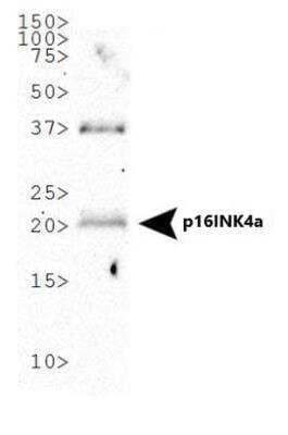 Western Blot: Aggressive Tumor Markers Antibody Pack [NBP1-78939] - Detection of p19ARF in MEF lysate (25ug) (2ug/ml) using NB200-106