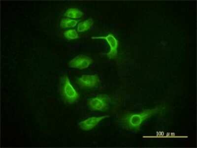 Immunocytochemistry/Immunofluorescence: Ago2/eIF2C2 Antibody (2E12-1C9) [H00027161-M01] - Analysis of monoclonal antibody to EIF2C2 on HeLa cell. Antibody concentration 10 ug/ml.