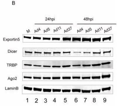 <b>Genetic Strategies Validation. </b>Western Blot: Ago2/eIF2C2 Antibody (2E12-1C9) [H00027161-M01] - The impact of different HAd infections on RNAi/miRNA-pathway proteins.HAd infections do not affect RNAi/miRNA-pathway protein levels. Western blot analysis on the same protein samples as in panel A was used to monitor the levels of RNAi/miRNA-pathway proteins Exportin 5, Dicer, TRBP and Ago2/eIF2C2. Detection of the Lamin B protein served as a loading control. Letter 