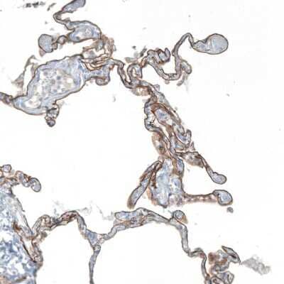 Immunohistochemistry-Paraffin: Agrin Antibody [NBP1-90209] - Staining of human lung shows moderate membranous positivity in pneumocytes.