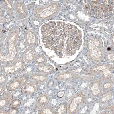 Immunohistochemistry-Paraffin: Agrin Antibody [NBP1-90209] - Staining of human kidney shows weak membranous positivity in cells in glomeruli.