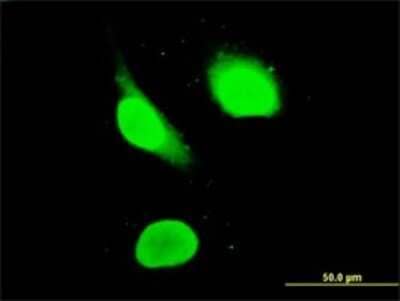 Immunocytochemistry/Immunofluorescence: Aiolos/IKZF3 Antibody (1D7) [H00022806-M02] - Analysis of monoclonal antibody to IKZF3 on HeLa cell. Antibody concentration 10 ug/ml.