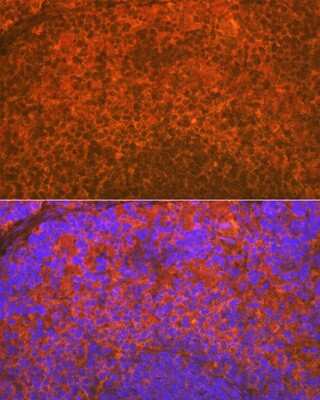 Immunohistochemistry: Aiolos/IKZF3 Antibody (4V2Z2) [NBP3-16668] - Immunofluorescence analysis of rat spleen using Aiolos/IKZF3 Rabbit mAb (NBP3-16668) at dilution of 1:100 (40x lens). Blue: DAPI for nuclear staining.