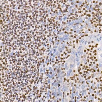 Immunohistochemistry-Paraffin: Aiolos/IKZF3 Antibody (4V2Z2) [NBP3-16668] - Immunohistochemistry of paraffin-embedded human tonsil using Aiolos/IKZF3 antibody (NBP3-16668) at dilution of 1:100 (40x lens).Perform high pressure antigen retrieval with 10 mM citrate buffer pH 6.0 before commencing with IHC staining protocol.