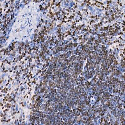 Immunohistochemistry-Paraffin: Aiolos/IKZF3 Antibody (4V2Z2) [NBP3-16668] - Immunohistochemistry of paraffin-embedded mouse spleen using Aiolos/IKZF3 antibody (NBP3-16668) at dilution of 1:100 (40x lens).Perform high pressure antigen retrieval with 10 mM citrate buffer pH 6.0 before commencing with IHC staining protocol.