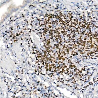 Immunohistochemistry-Paraffin: Aiolos/IKZF3 Antibody (4V2Z2) [NBP3-16668] - Immunohistochemistry of paraffin-embedded rat lung using Aiolos/IKZF3 antibody (NBP3-16668) at dilution of 1:100 (40x lens).Perform high pressure antigen retrieval with 10 mM citrate buffer pH 6.0 before commencing with IHC staining protocol.