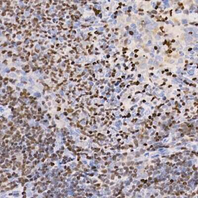 Immunohistochemistry-Paraffin: Aiolos/IKZF3 Antibody (4V2Z2) [NBP3-16668] - Immunohistochemistry of paraffin-embedded rat spleen using Aiolos/IKZF3 antibody (NBP3-16668) at dilution of 1:100 (40x lens).Perform high pressure antigen retrieval with 10 mM citrate buffer pH 6.0 before commencing with IHC staining protocol.